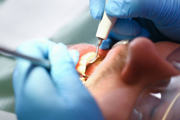 Best Emergency Orthodontic Services in Algonquin, IL